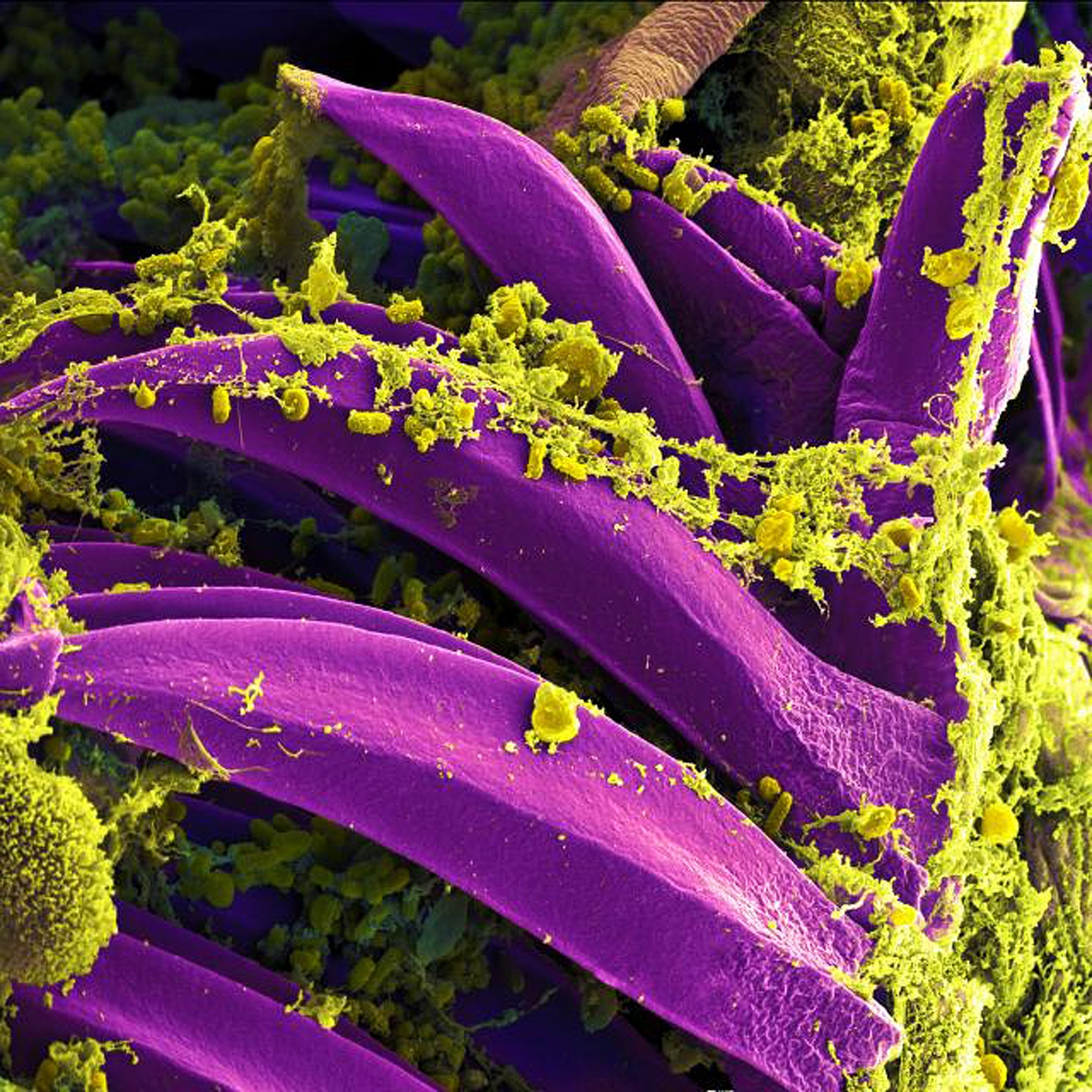 The Future of Cannabinoid Cultivation? Bioengineered Yeast Loaded with Cannabis Genes Produces Mother of All Cannabinoids